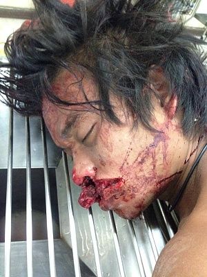lip-20gash-20-281-29.jpg