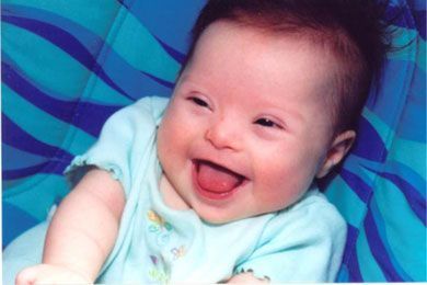 babies_with_birth_defects_010.jpg