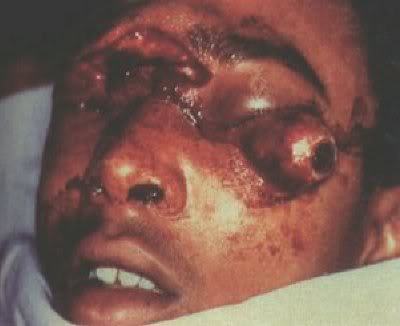 hj-eye4.jpg