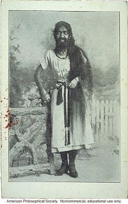 906-bearded-woman-hypertrichosis.jpg
