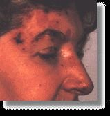 opto_zona.jpg
