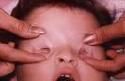 noeyes.jpg