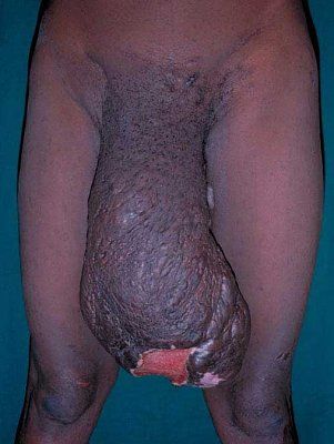 biggest-20penis.jpg