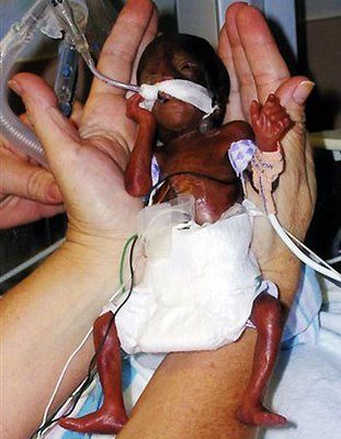 Name:  2_21_tiny_baby1-771691.jpg
Views: 180
Size:  31.4 KB