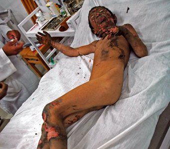 nato_victim2.jpg