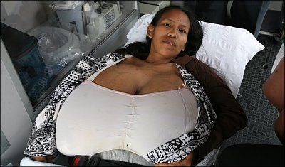bm_boobs_682_3_1036360a.jpg