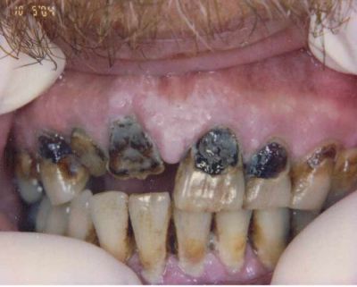 Name:  gross_teeth_006.jpg
Views: 4173
Size:  22.2 KB