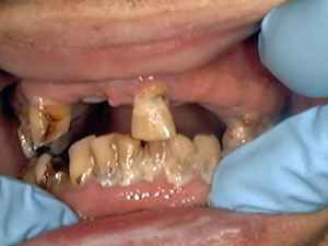 Name:  gross_teeth_012.jpg
Views: 3835
Size:  9.6 KB