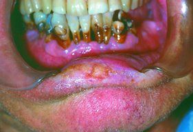 Name:  gross_teeth_013.jpg
Views: 3952
Size:  15.5 KB