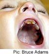Name:  gross_teeth_017.jpg
Views: 3700
Size:  4.0 KB