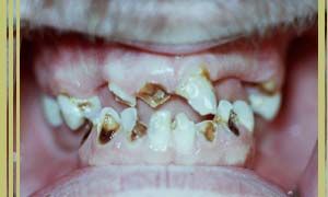 Name:  gross_teeth_018.jpg
Views: 4122
Size:  11.8 KB