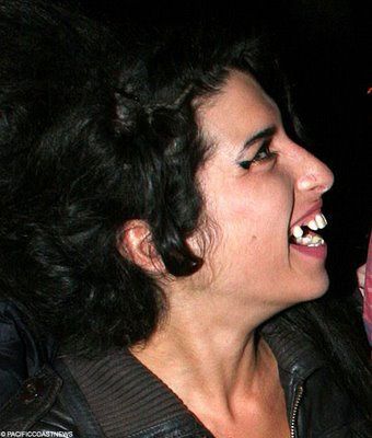 Name:  gross_teeth_026.jpg
Views: 3884
Size:  26.7 KB
