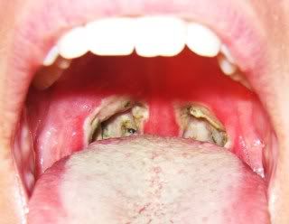 Name:  Mouth005.jpg
Views: 3747
Size:  17.5 KB
