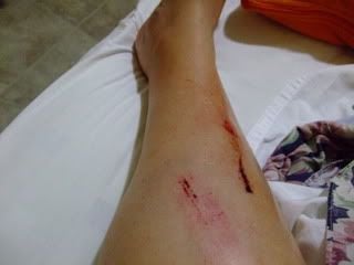 raft_ridding_accident_pics_002.jpg