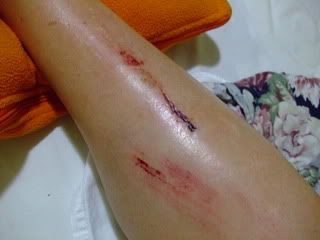 Name:  raft_ridding_accident_pics_001.jpg
Views: 71
Size:  12.0 KB