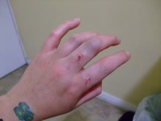 Name:  raft_ridding_accident_pics_003.jpg
Views: 87
Size:  8.3 KB