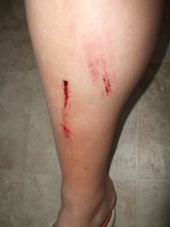 Name:  raft_ridding_accident_pics_004.jpg
Views: 90
Size:  9.6 KB