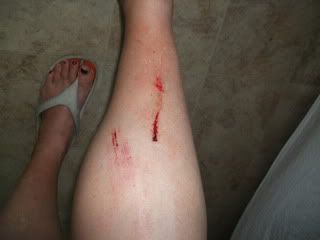 Name:  raft_ridding_accident_pics_005.jpg
Views: 77
Size:  8.7 KB