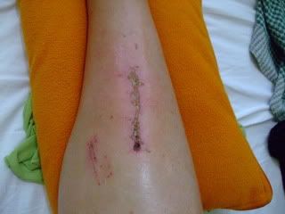 Name:  raft_ridding_accident_pics_006.jpg
Views: 89
Size:  12.3 KB