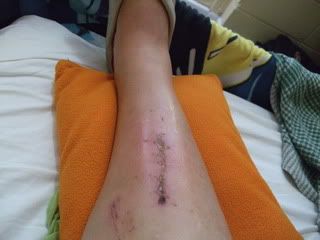Name:  raft_ridding_accident_pics_007.jpg
Views: 85
Size:  13.3 KB
