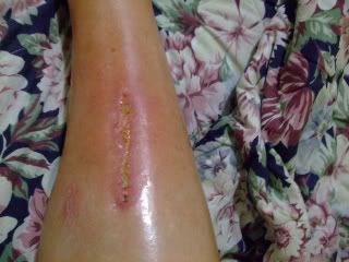 Name:  raft_ridding_accident_pics_009.jpg
Views: 91
Size:  16.7 KB