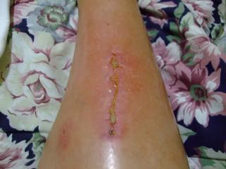 Name:  raft_ridding_accident_pics_010.jpg
Views: 81
Size:  14.4 KB