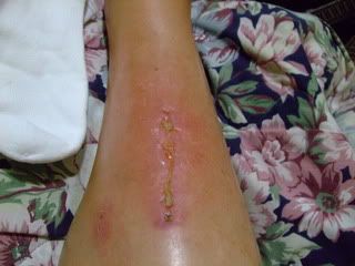 Name:  raft_ridding_accident_pics_011.jpg
Views: 98
Size:  16.0 KB