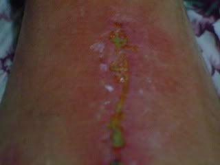 Name:  raft_ridding_accident_pics_012.jpg
Views: 96
Size:  7.6 KB
