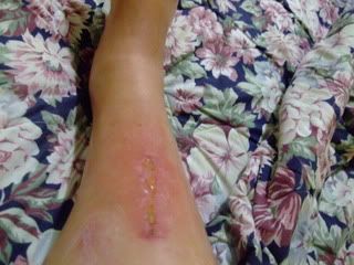 Name:  raft_ridding_accident_pics_013.jpg
Views: 94
Size:  21.1 KB