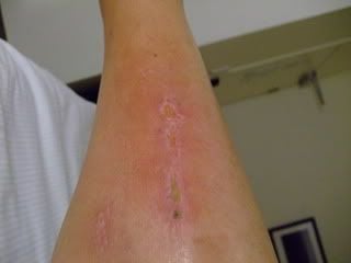 Name:  raft_ridding_accident_pics_014.jpg
Views: 75
Size:  7.6 KB
