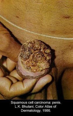 pic-dis-penis1.jpg