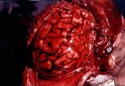 neurotrauma13a-2b.jpg