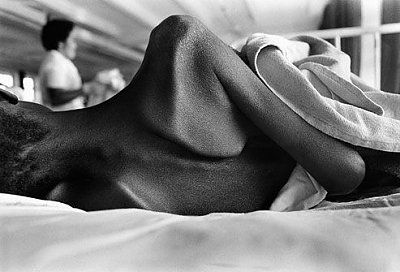 corbis_rm_photo_of_african_aids_patient.jpg