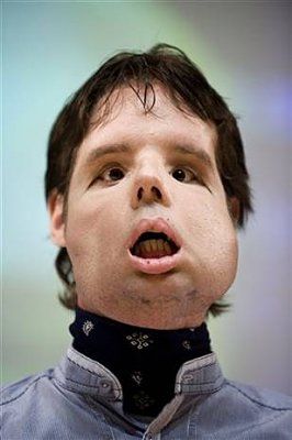 male_face_transplant.jpg