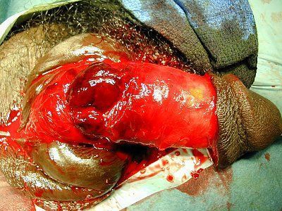 trauma-penis31.jpg