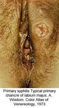 Name:  pic-dis-mokv3.jpg
Views: 5556
Size:  28.7 KB