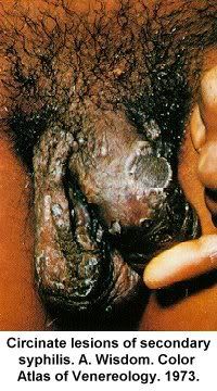 Name:  pic-dis-penis7.jpg
Views: 5308
Size:  28.6 KB