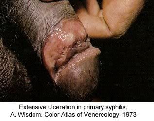 Name:  pic-dis-penis8.jpg
Views: 6824
Size:  18.8 KB