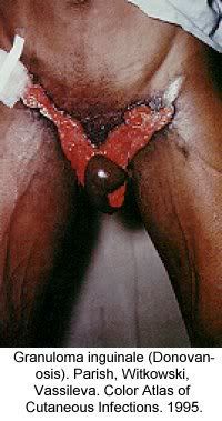 Name:  pic-dis-penis11.jpg
Views: 5365
Size:  20.5 KB