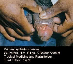 Name:  pic-dis-penis13.jpg
Views: 5167
Size:  22.2 KB