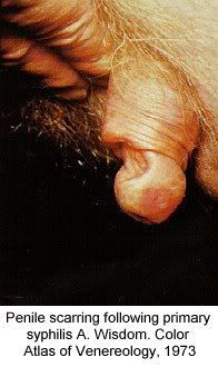 Name:  pic-dis-penis14.jpg
Views: 5160
Size:  17.2 KB