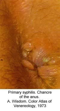 Name:  pic-dis-zele.jpg
Views: 5147
Size:  18.1 KB