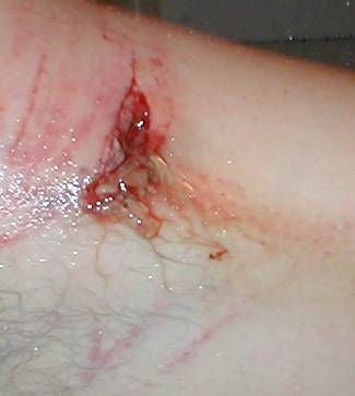 Name:  stiches.jpg
Views: 114
Size:  15.5 KB