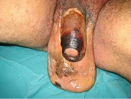 Name:  bad%202.jpg
Views: 879
Size:  8.8 KB
