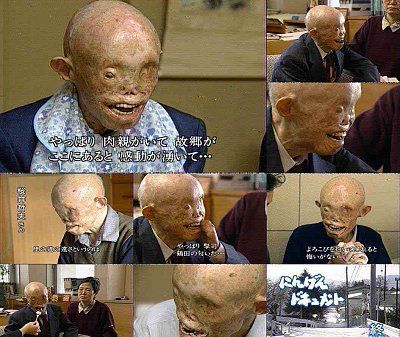 hiroshima_victim.jpg