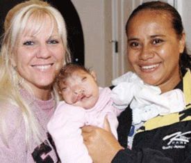 Name:  20080228_facial-deformity.jpg
Views: 767
Size:  17.2 KB