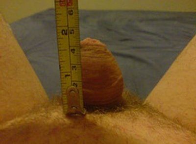 pictures_small_penis_002.jpg
