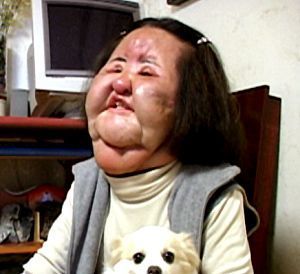 Name:  Hang%20Mioku%20Worst%20Plastic%20Surgery%20Disaster%20Procedure%203.jpg
Views: 3599
Size:  16.5 KB