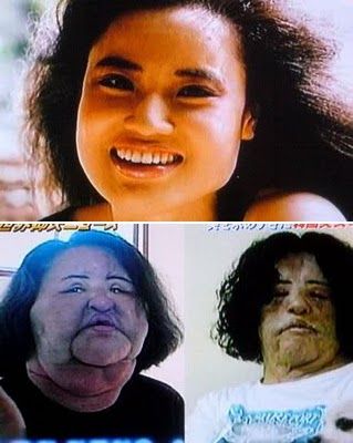 Name:  Hang%20Mioku%20Worst%20Plastic%20Surgery%20Disaster%20Procedure%202.jpg
Views: 2952
Size:  31.2 KB