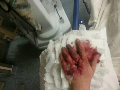 357-hand.jpg